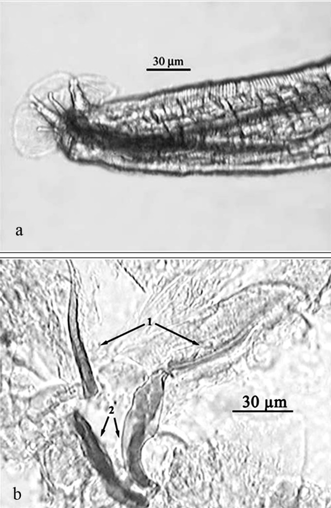 Structures of some widely distributed lung helminths (d)